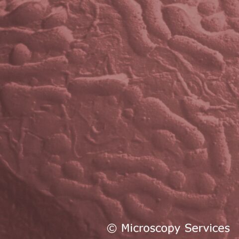 Gefrierbruchanalyse einer  humanen Muttermilchprobe