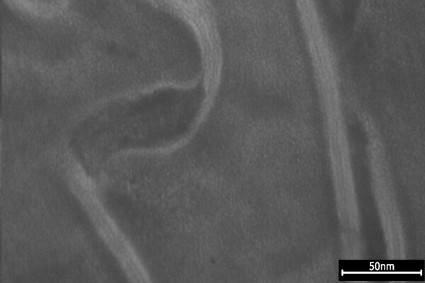 Lipidlamellen im S. corneum 24h nach der Blue-Light Anwendung