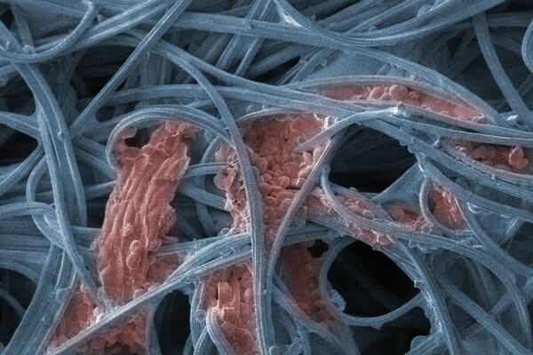 Fasern der Gesichtsmaske nach der Anwendung