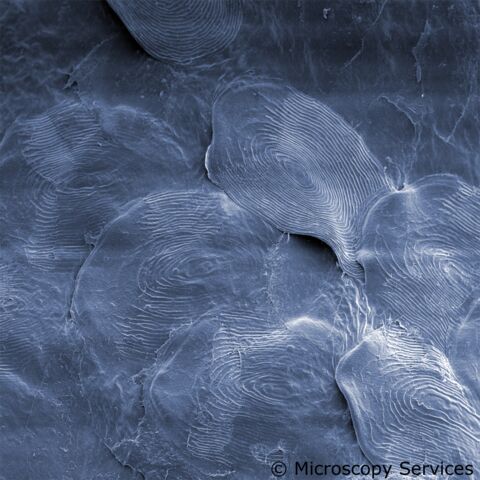 Fischschuppen im Rasterelektronenmikroskop