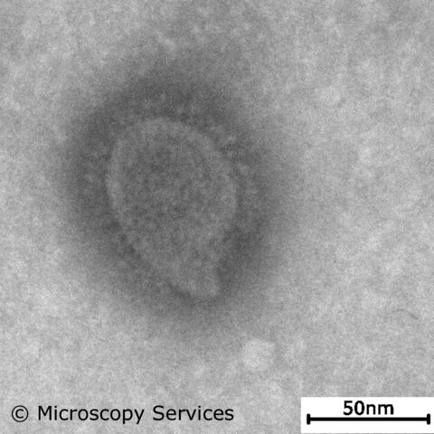 TEM Aufnahme Coronavirus