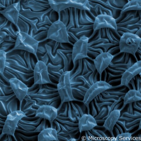 Oberflächenstruktur der Bettwanze  (REM)