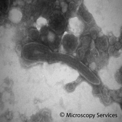 Negative Staining / Negativ Kontrastierung von Virusmaterial (Ebola-Virus) im TEM