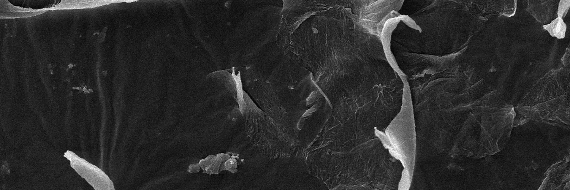 Liposomen (Gefrierbruch TEM)