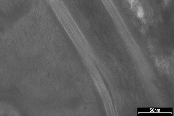 Lipidlamellen vor der Blue-Light Anwendung