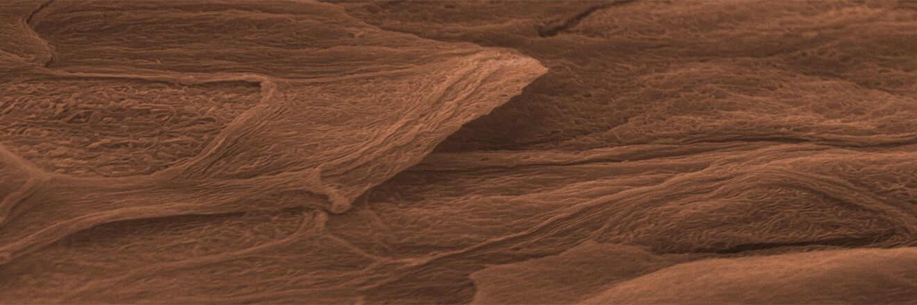 Corneozyten,in vitro 3D Hautmodell (REM)